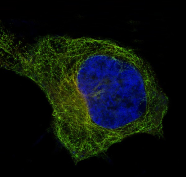 beta I Tubulin Ab