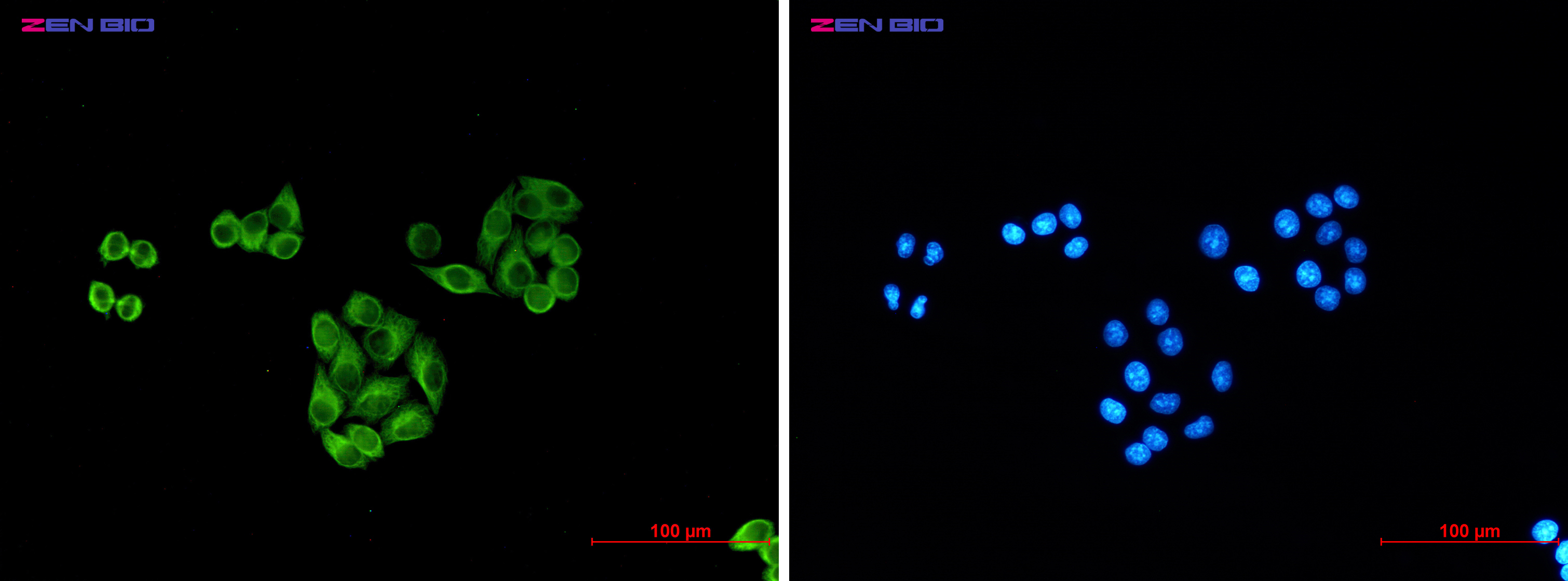 beta I Tubulin Ab