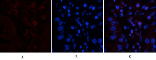 CD45 Ab