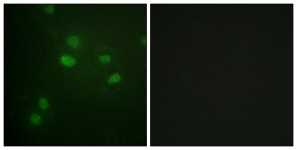 p-Histone H3 (T11) Ab
