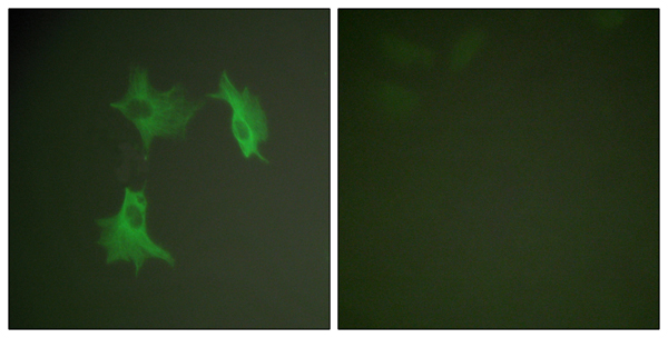alpha 1A Tubulin Ab