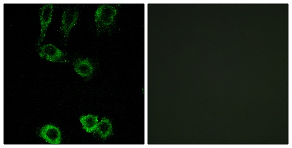 Calponin 2 Ab