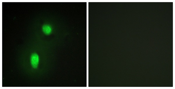 hnRNP C1/C2 Ab
