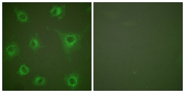 Collagen II alpha 1 Ab