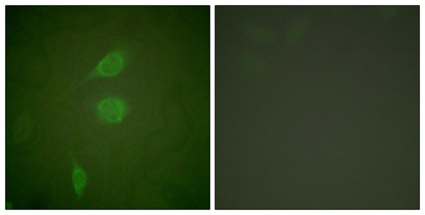 HDAC5 Ab