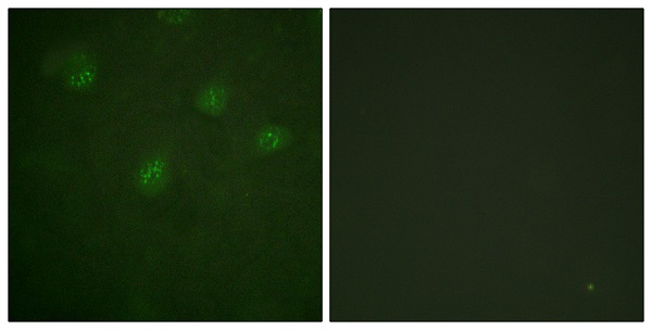 Estrogen receptor Ab