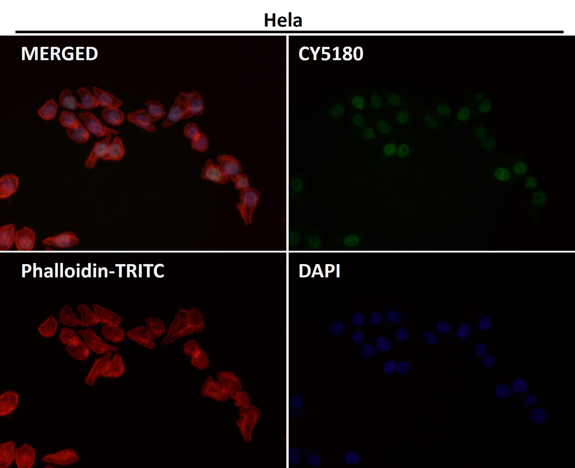 Acetyl-Histone H3 (K56) Ab