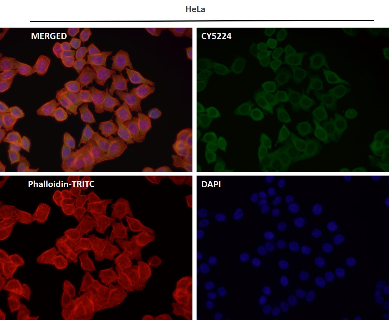 PI3 kinase p110 alpha Ab