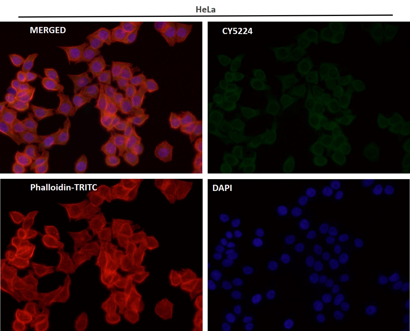 PI3 kinase p110 alpha Ab