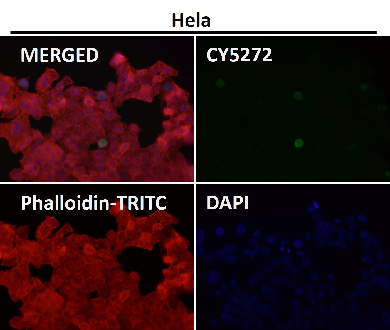 Acetyl-Histone H3 (K14) Ab