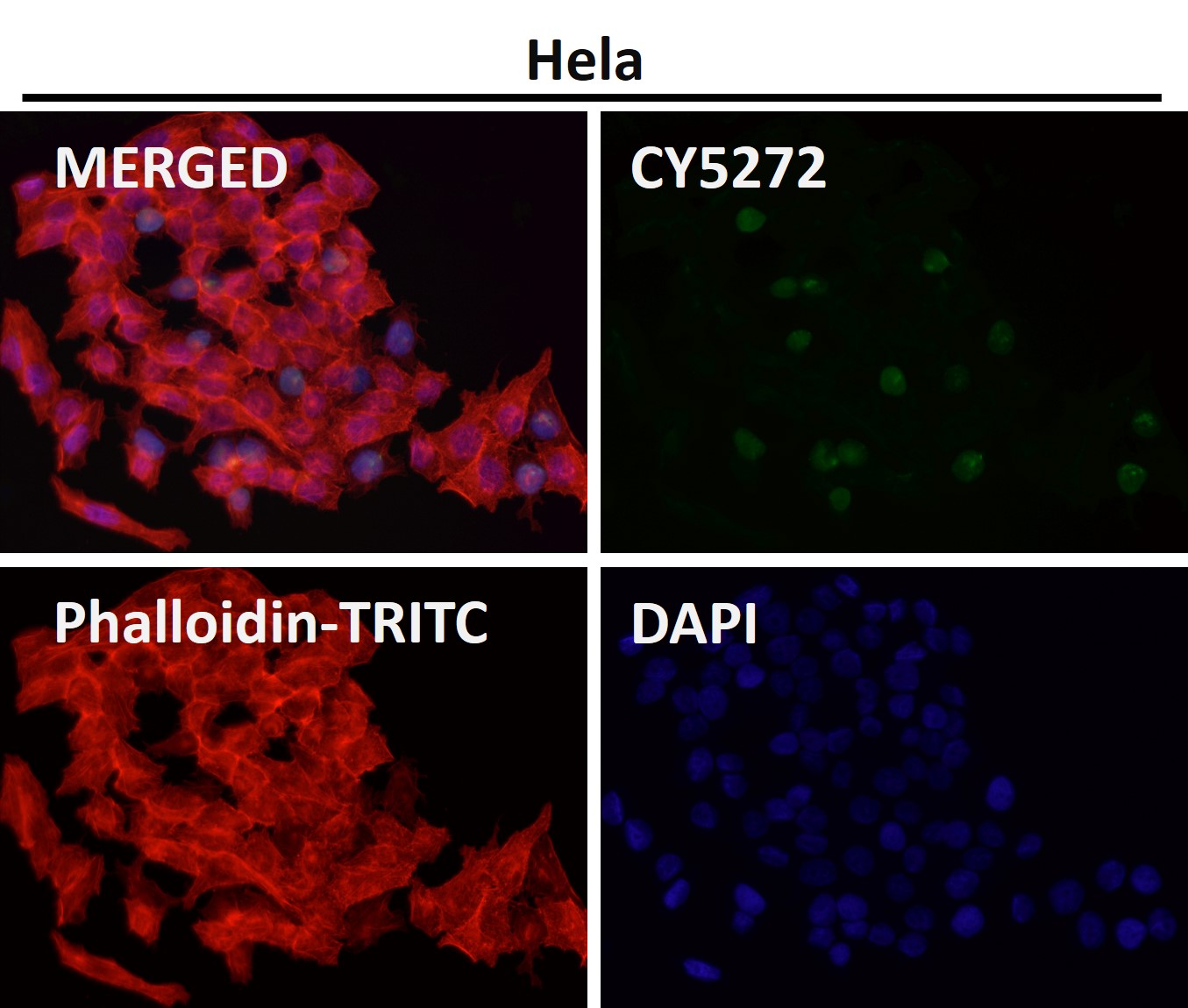 Acetyl-Histone H3 (K14) Ab