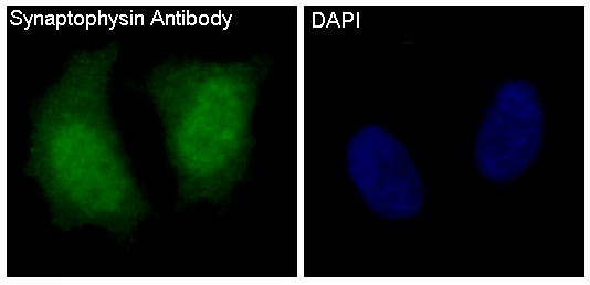 Synaptophysin Ab