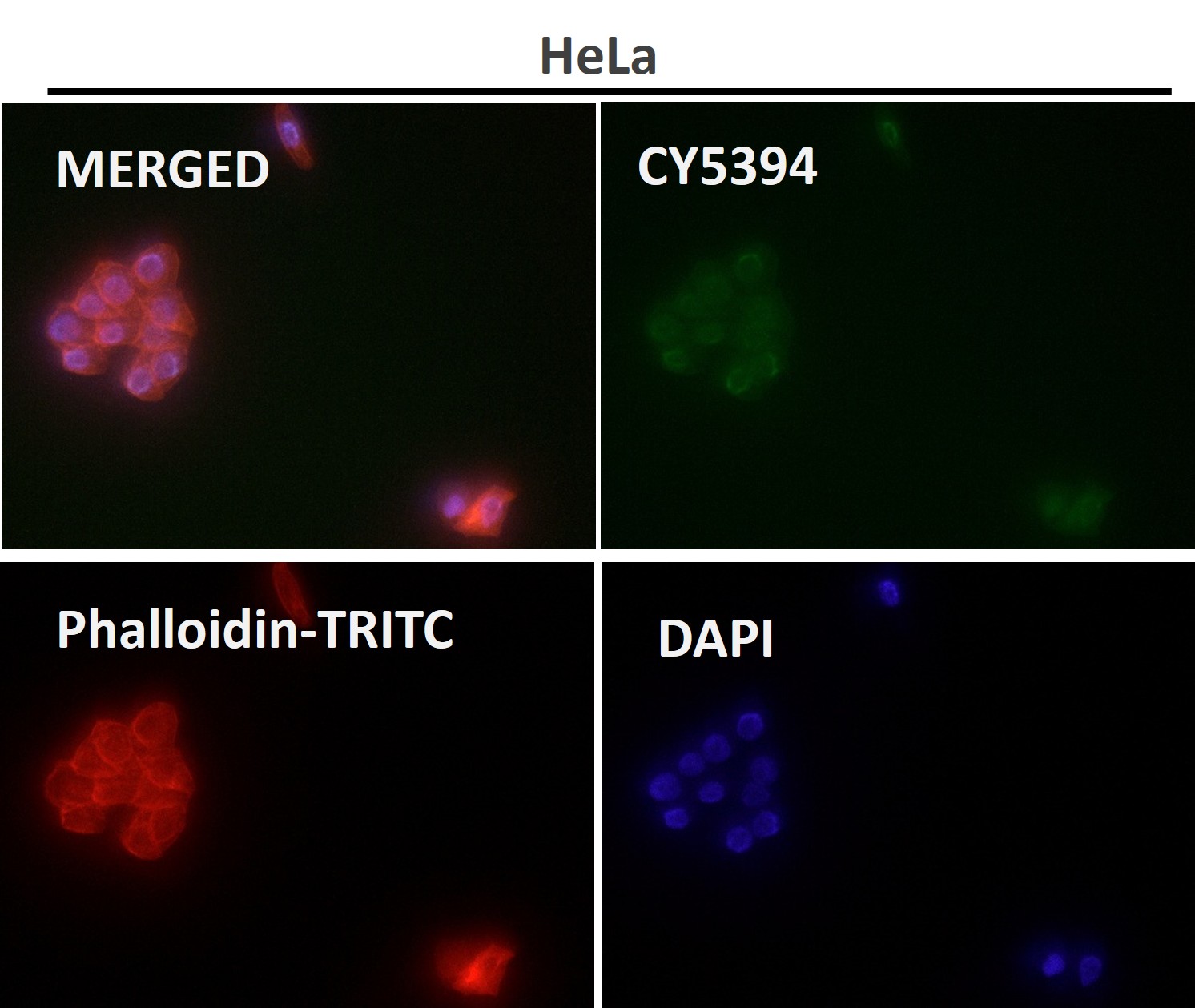 beta 2B/2A/4B Tubulin Ab