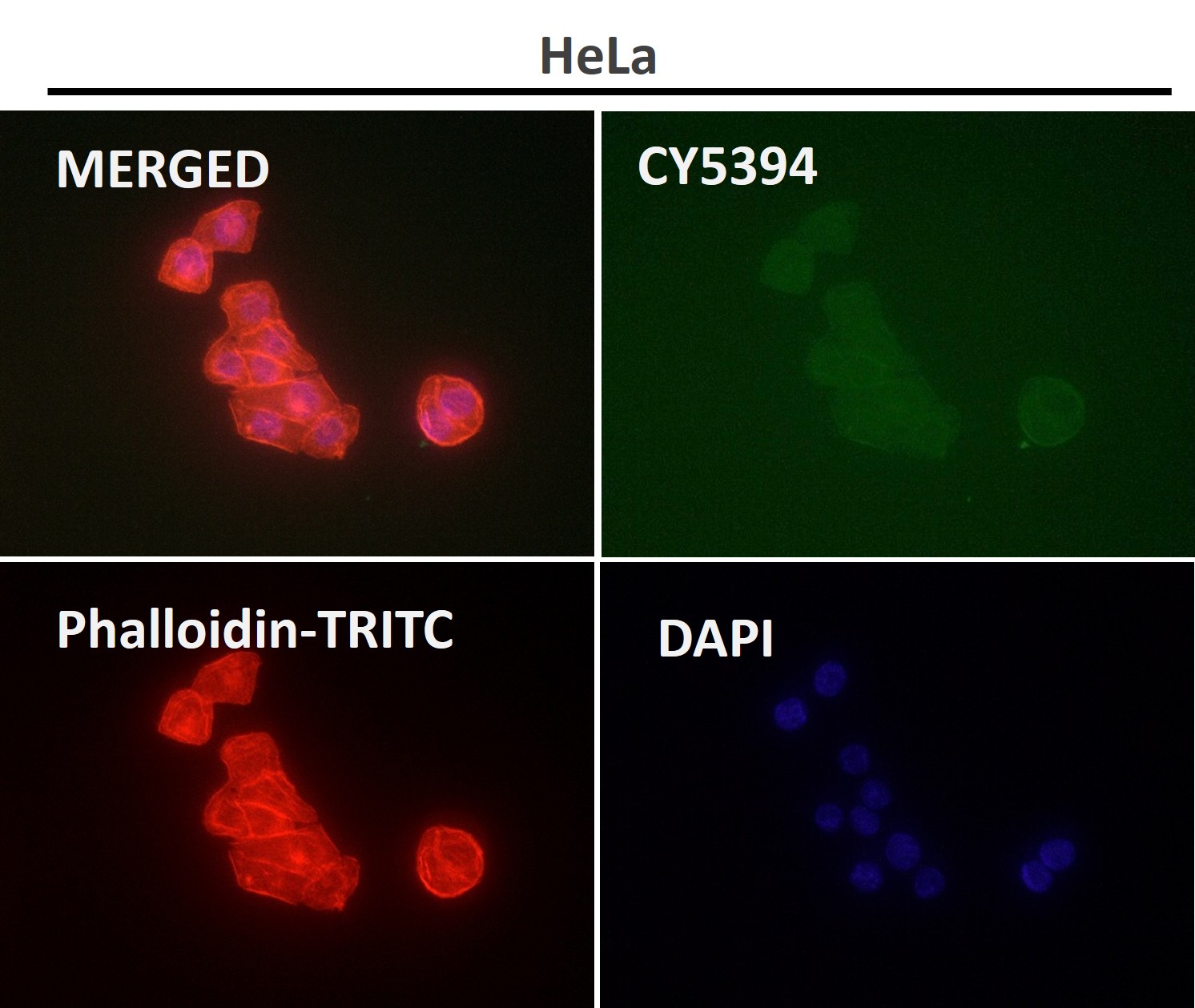 beta 2B/2A/4B Tubulin Ab