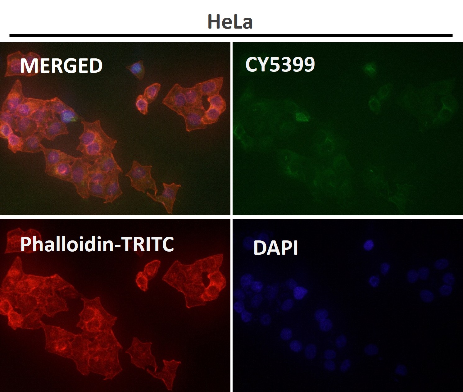 Cofilin Ab