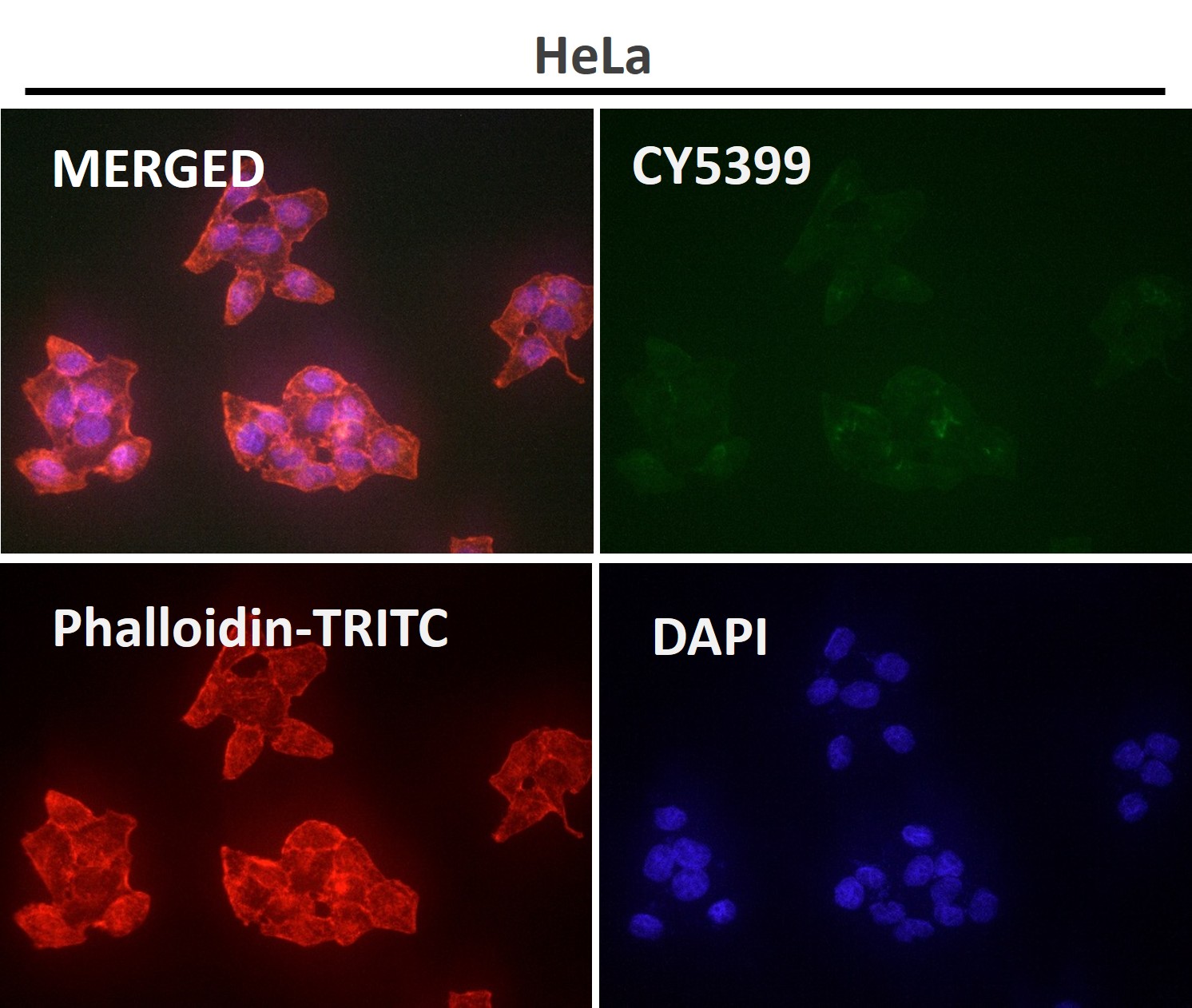 Cofilin Ab
