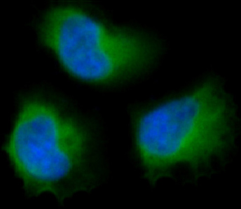 Focal adhesion kinase 1 Ab
