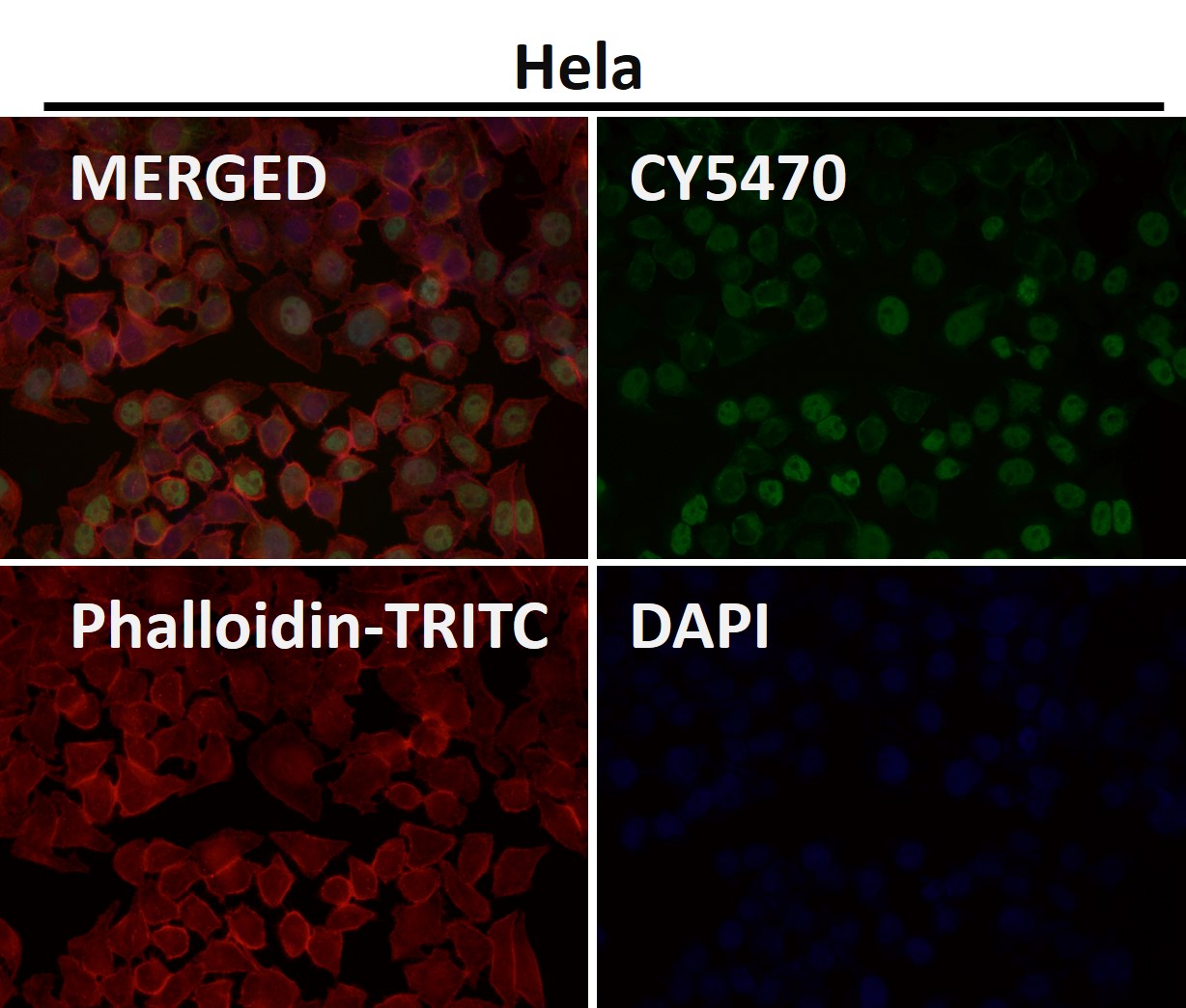 Acetyl-p53 (K370) Ab