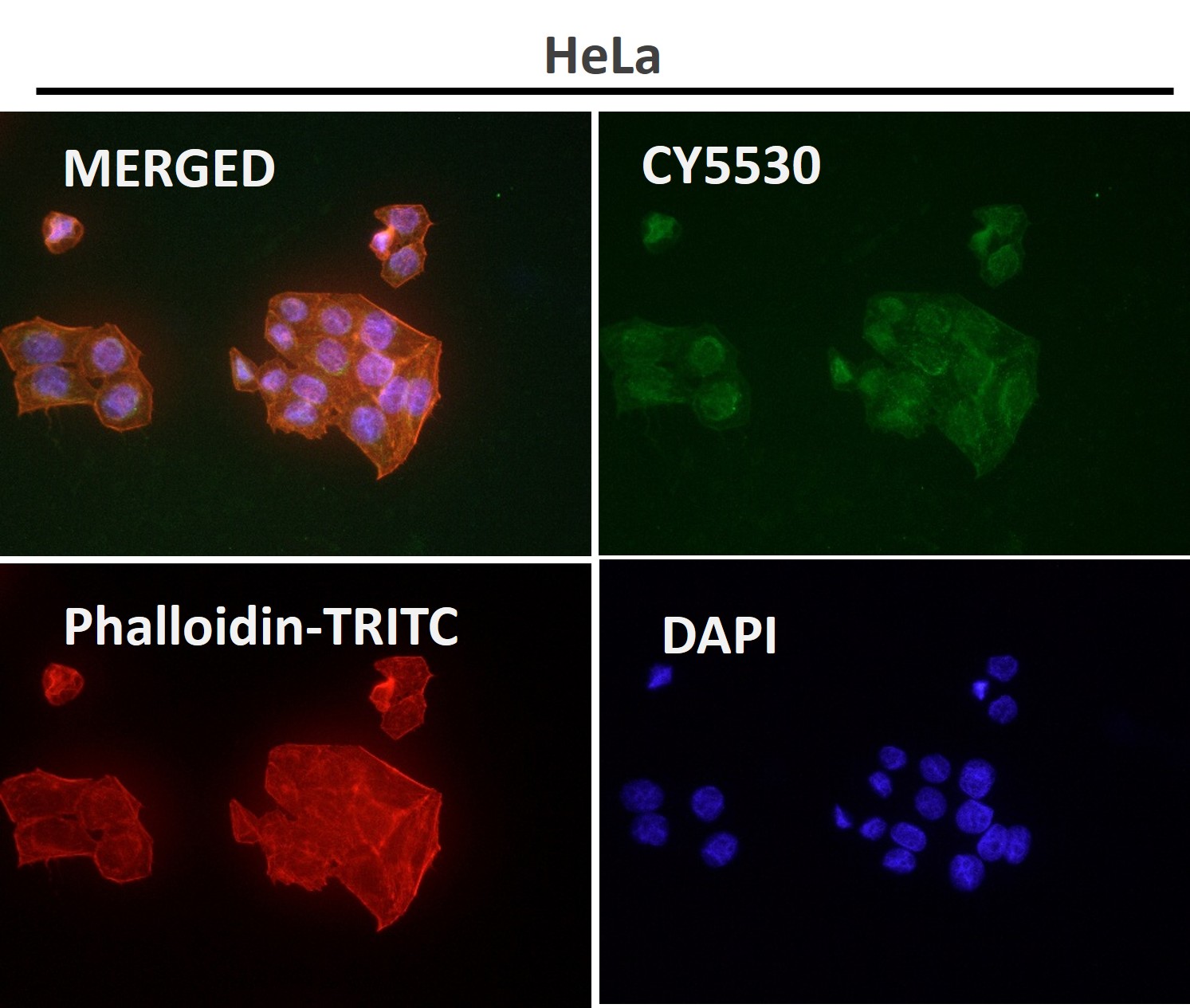 Hexokinase 1 Ab