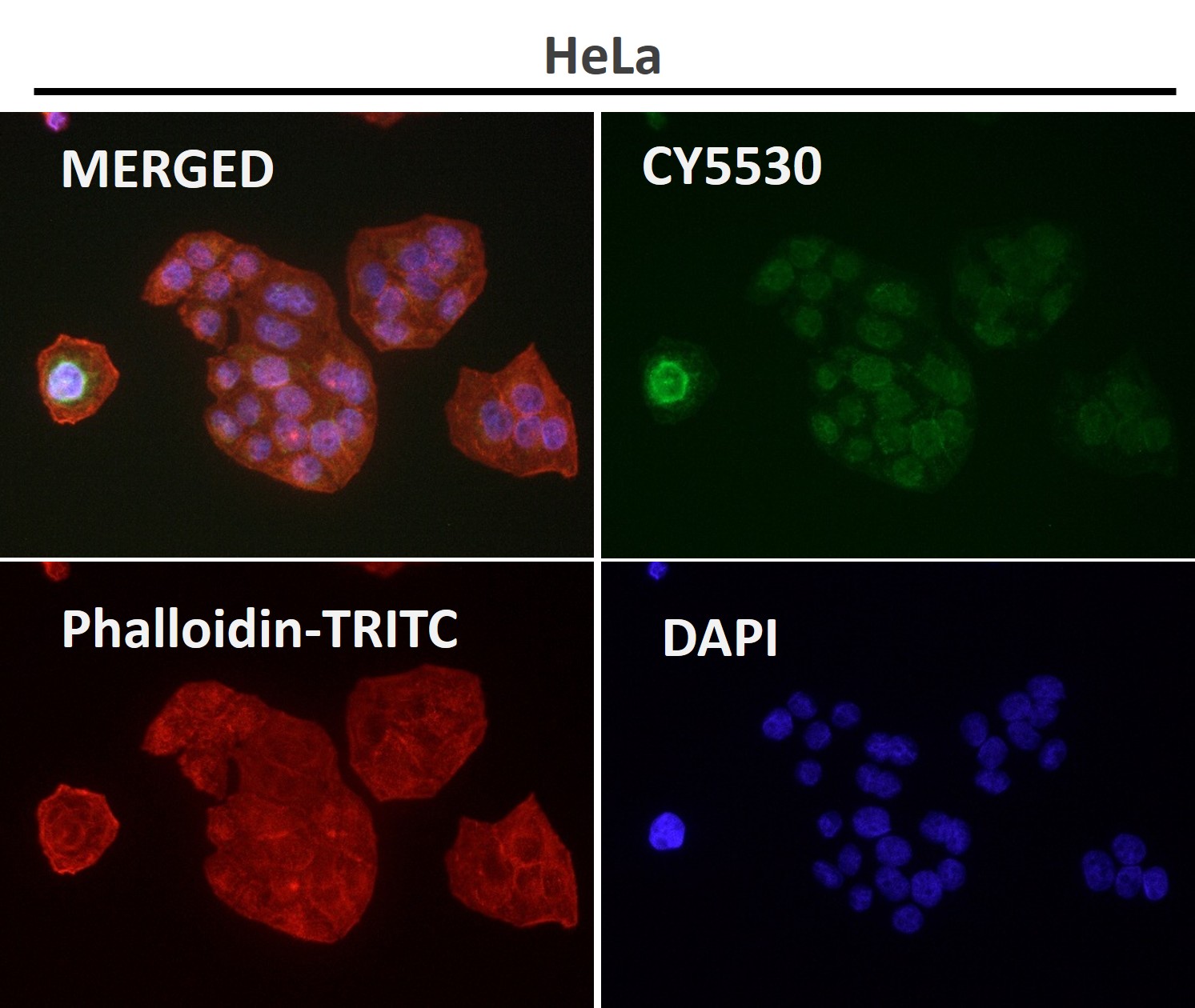 Hexokinase 1 Ab