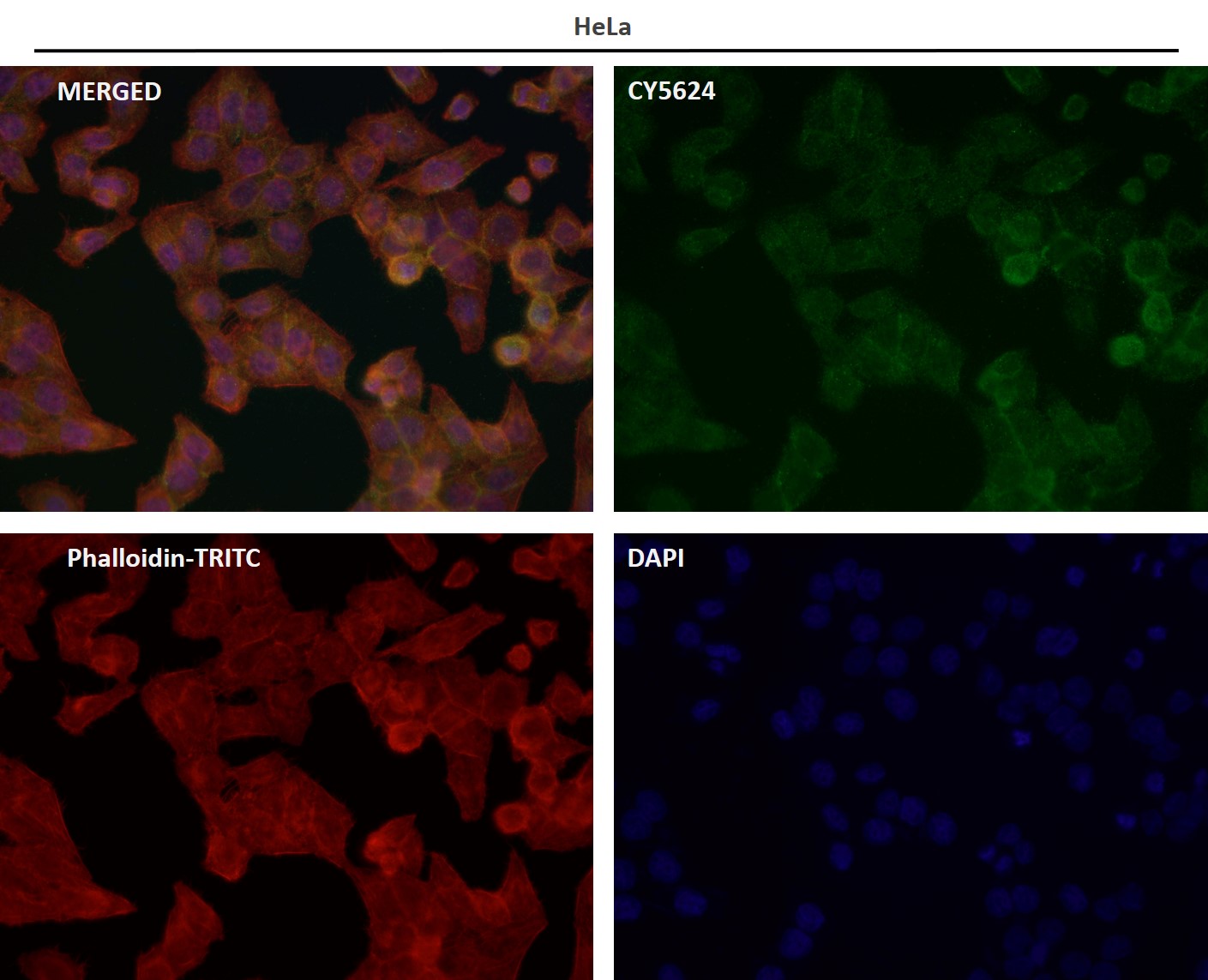 p-Estrogen receptor (S118) Ab
