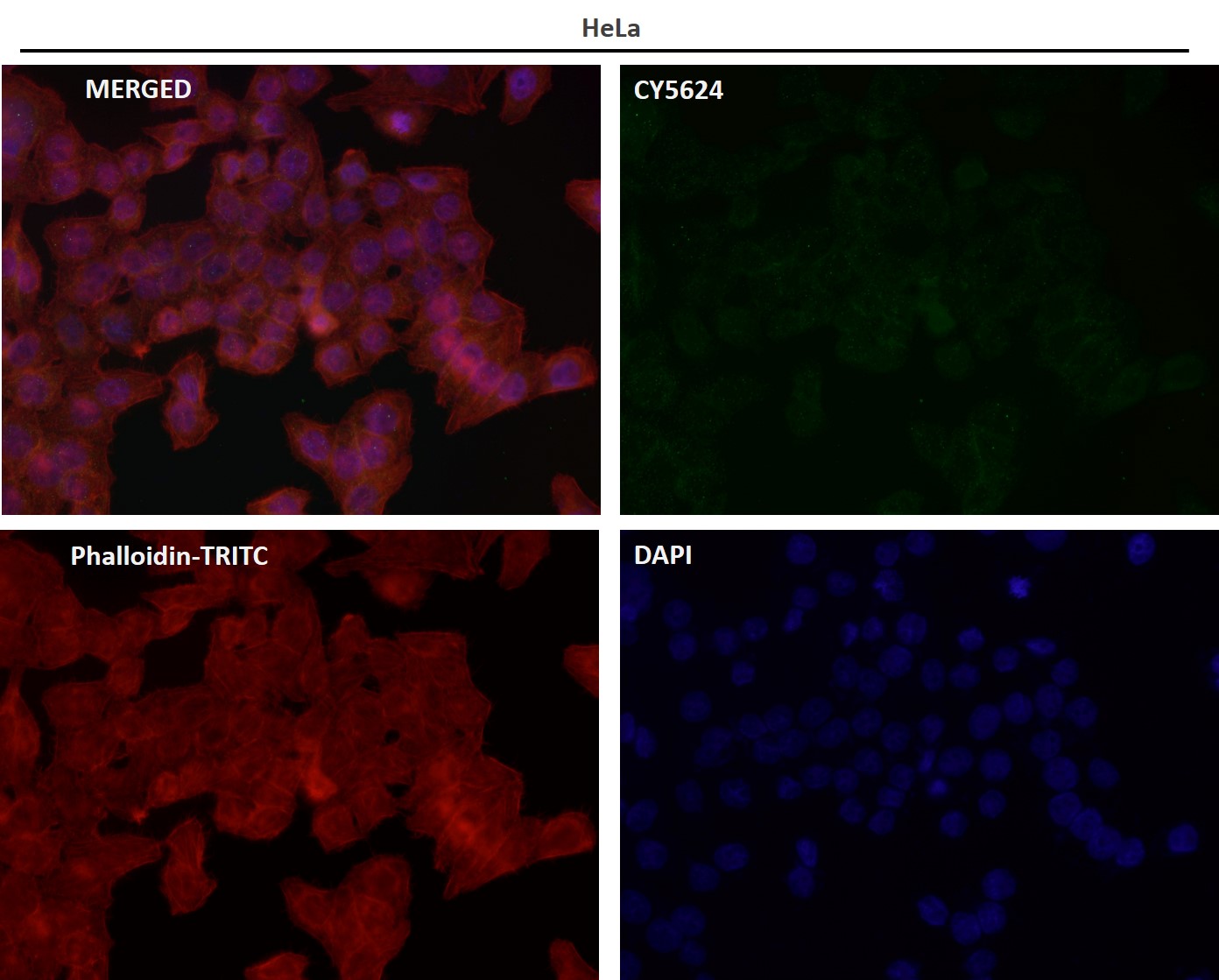 p-Estrogen receptor (S118) Ab