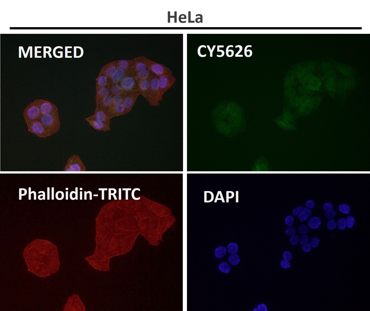 PEBP1 Ab