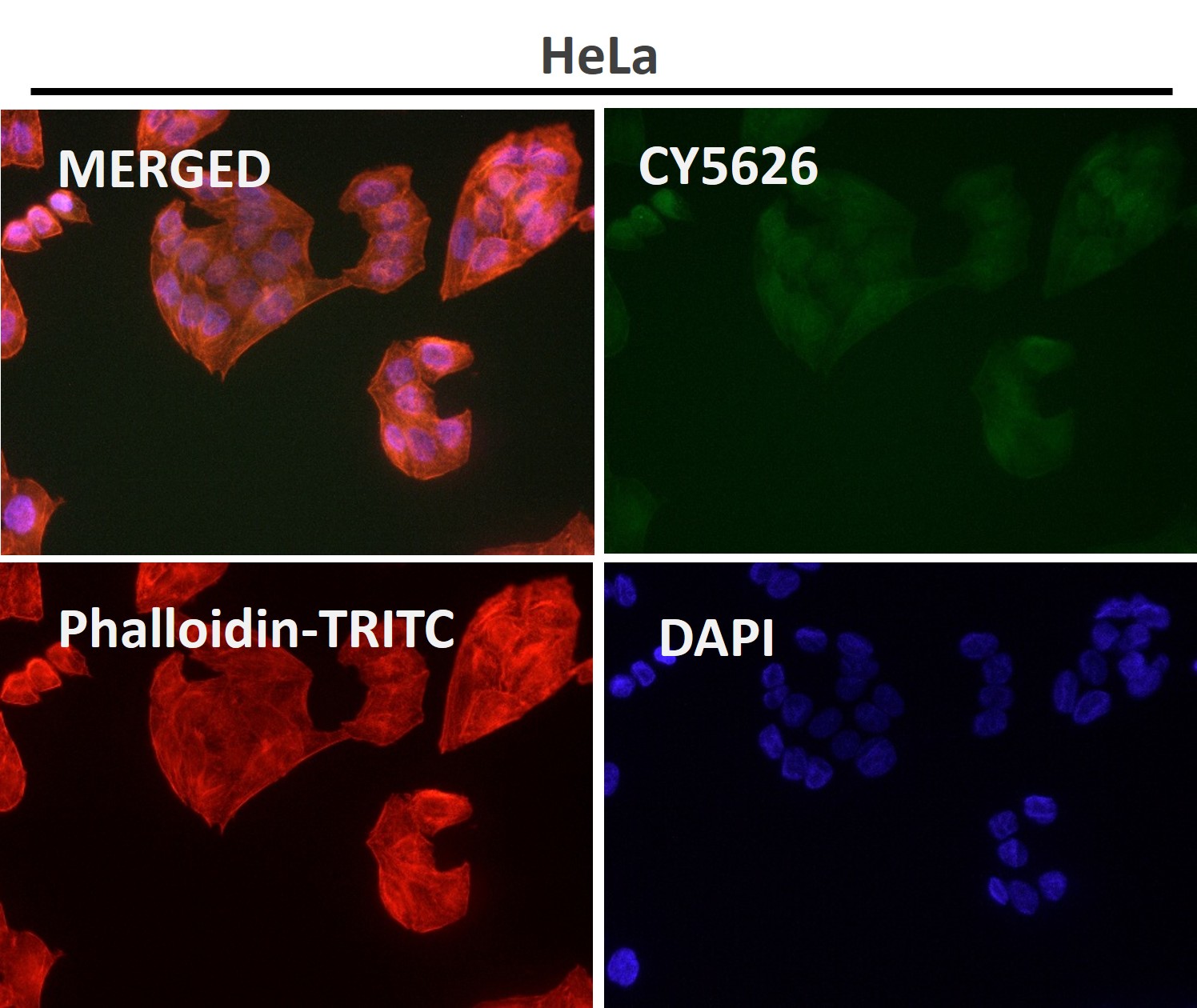 PEBP1 Ab