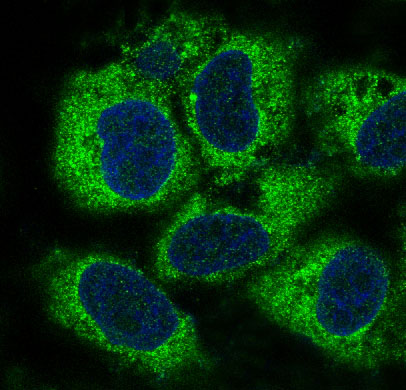 PEBP1 Ab