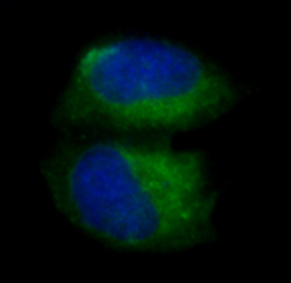 Caspase 3 Ab