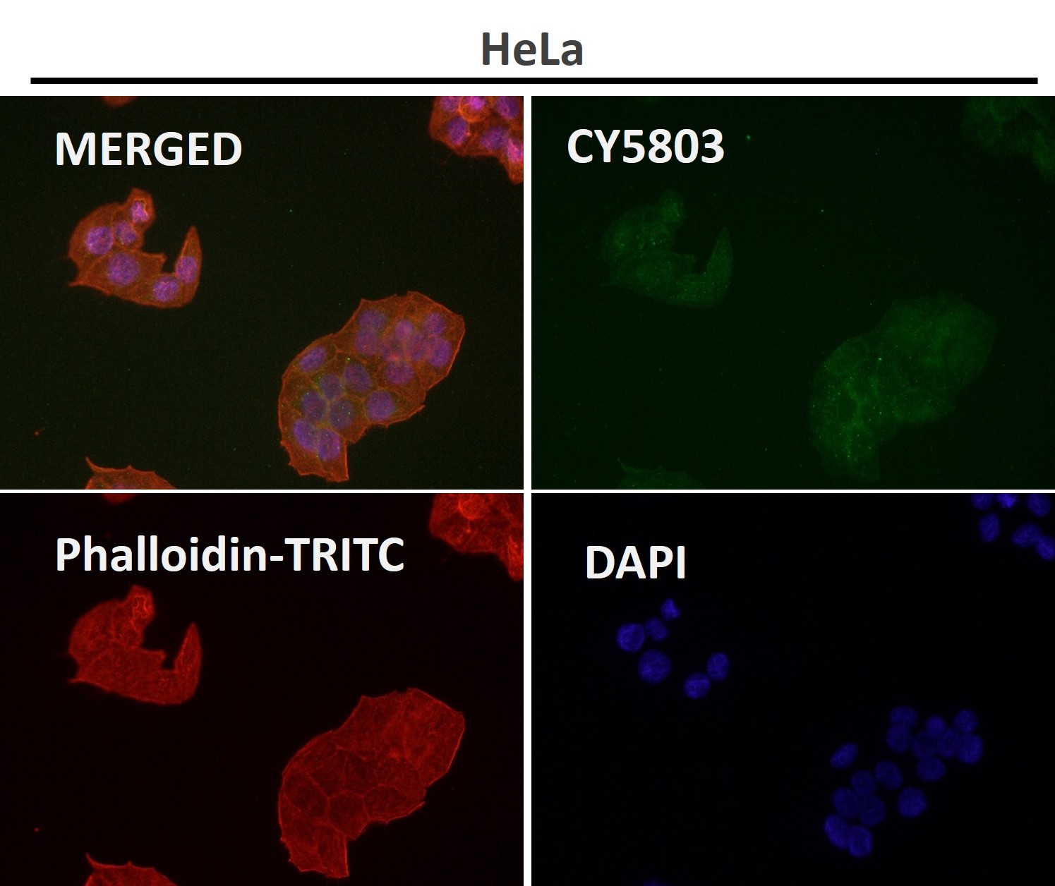 Insulin receptor Ab