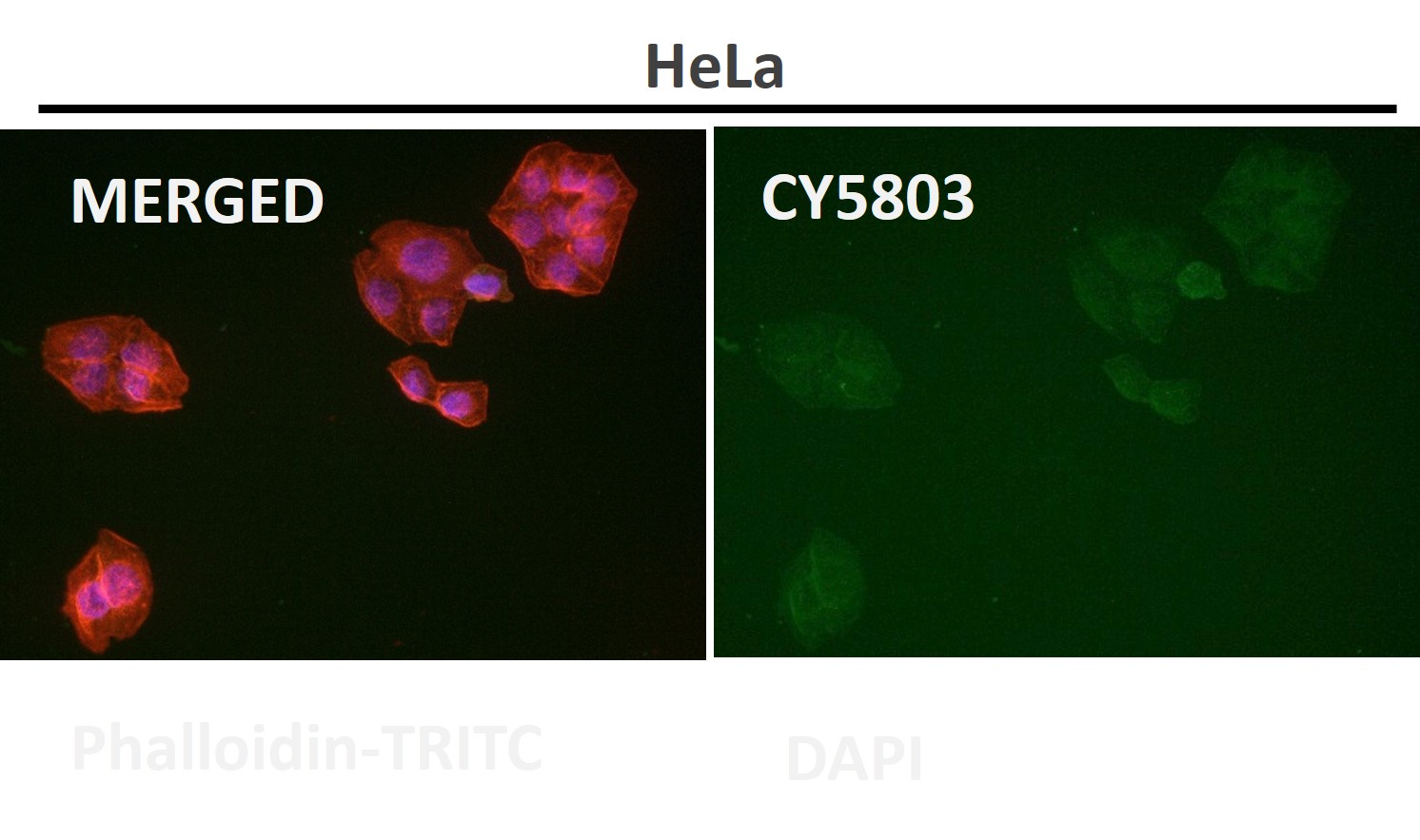 Insulin receptor Ab