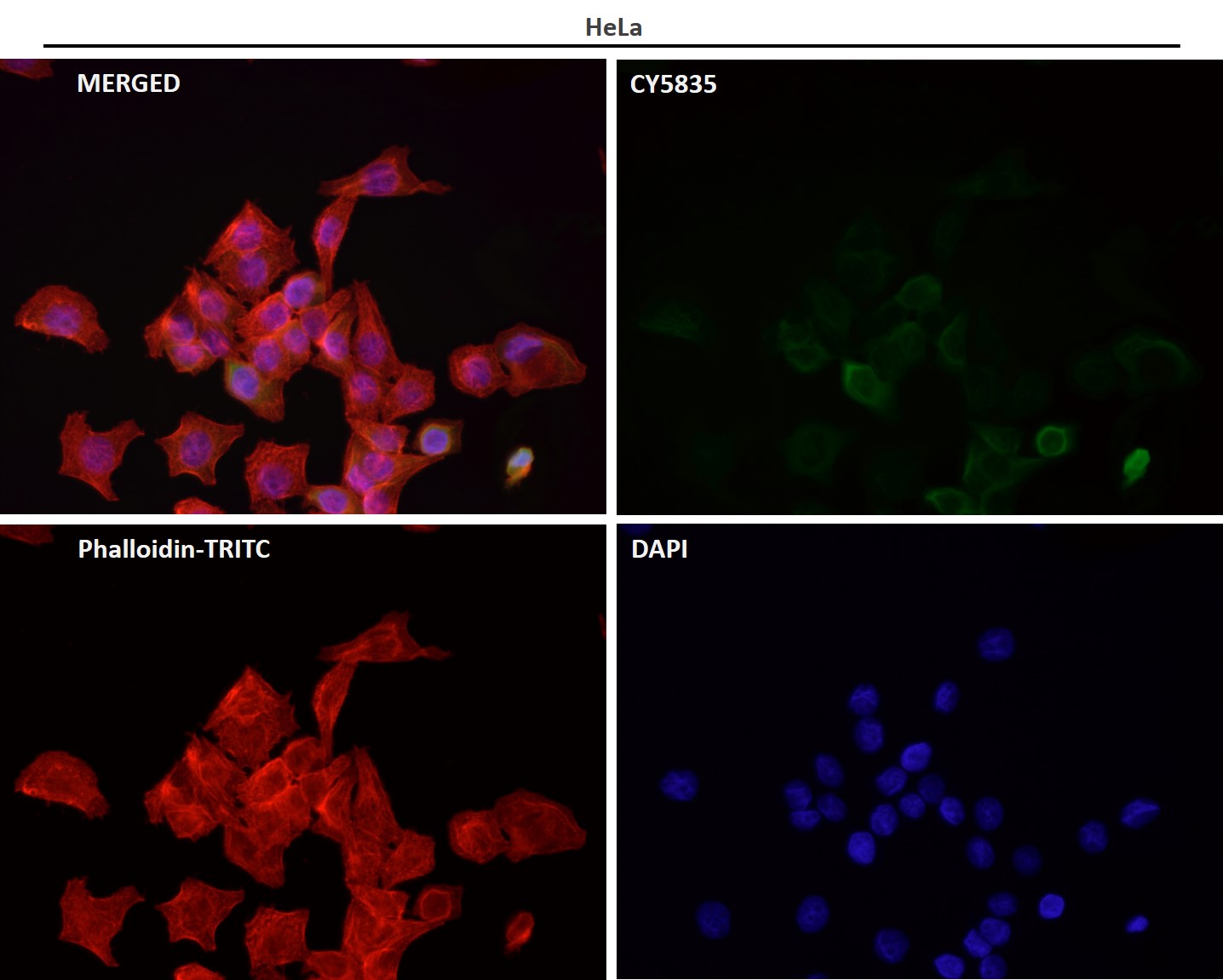 CDK6 Ab