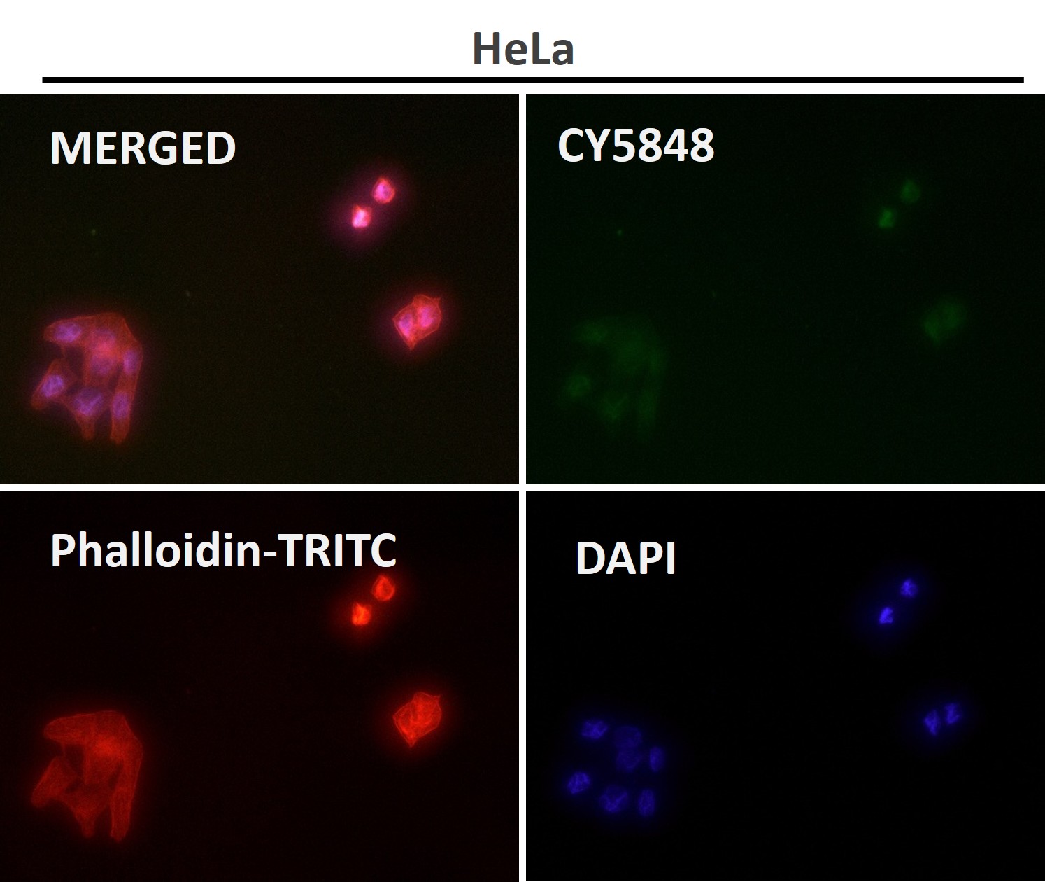 Histone H2B 1K Ab