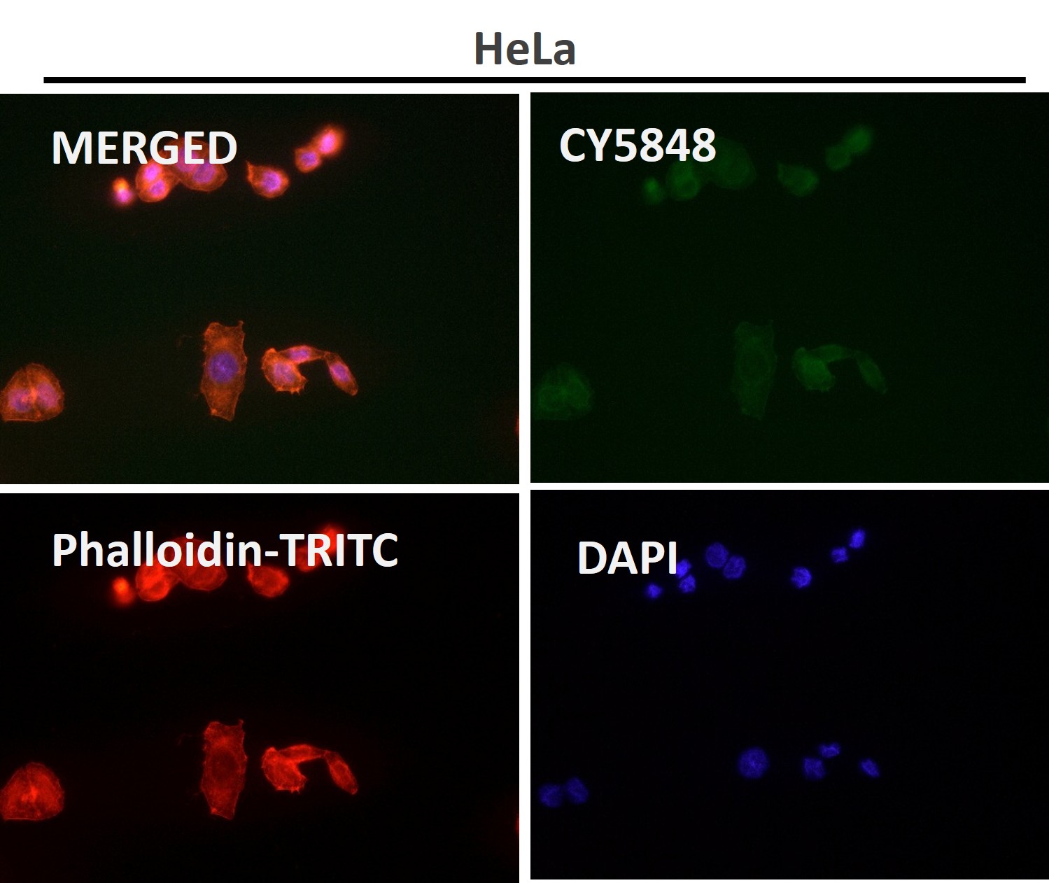 Histone H2B 1K Ab