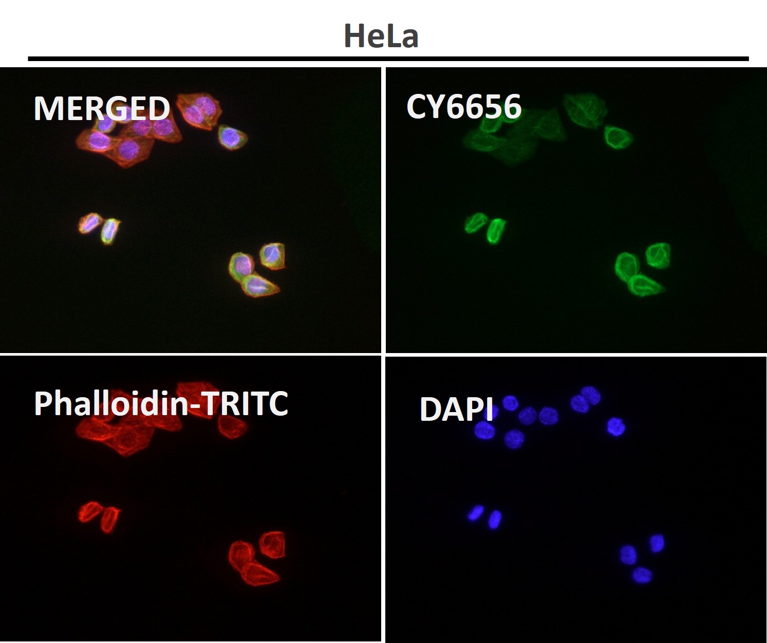 PDHA1 Ab