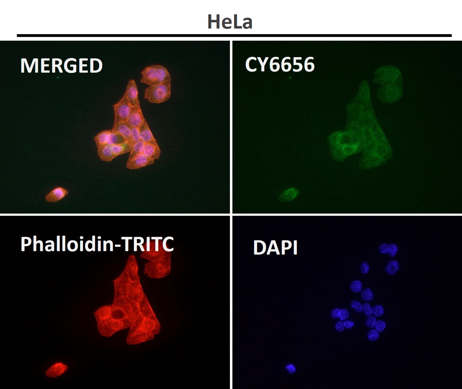 PDHA1 Ab