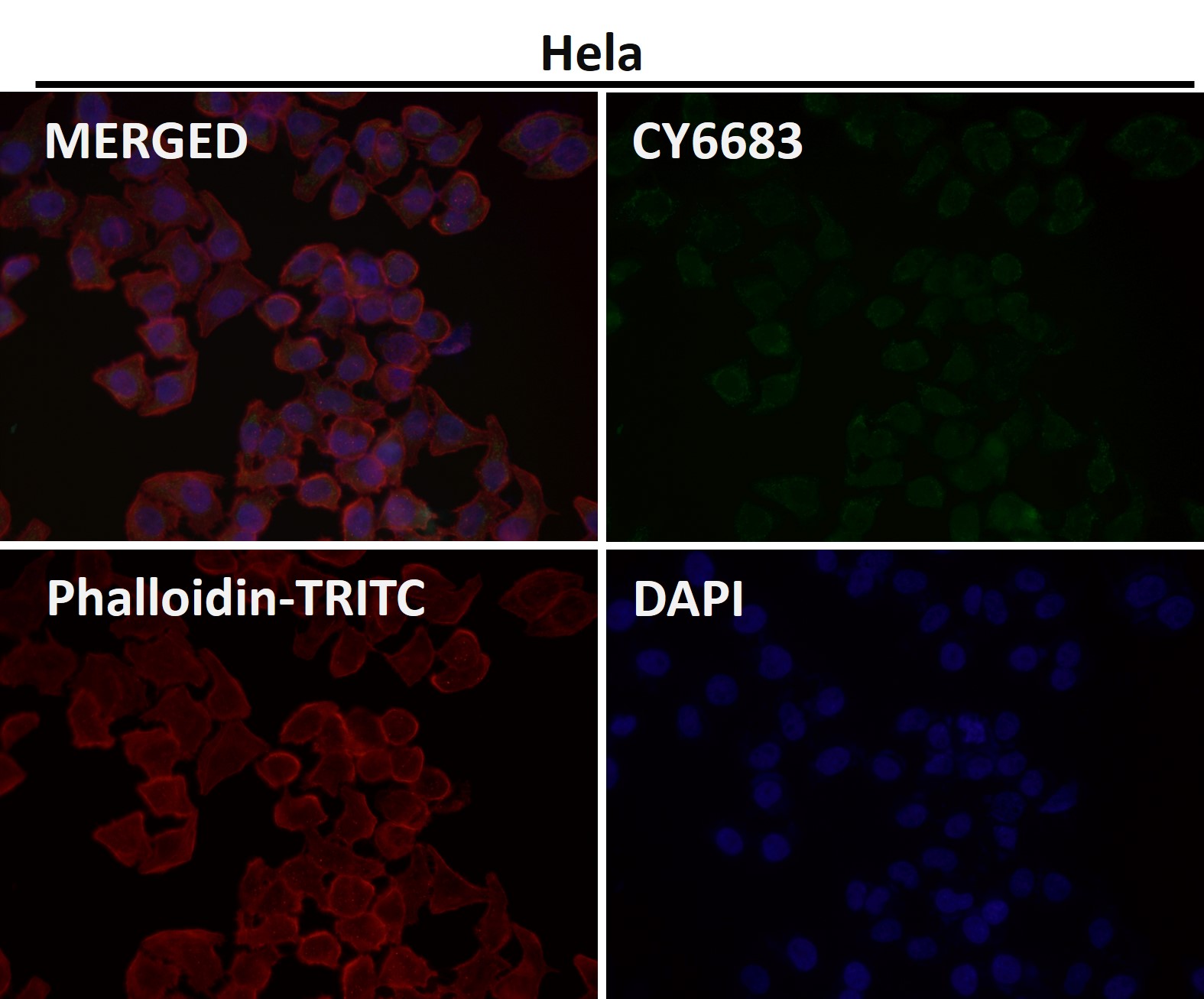 NCAM 1 Ab