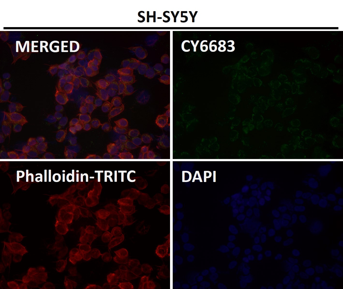 NCAM 1 Ab