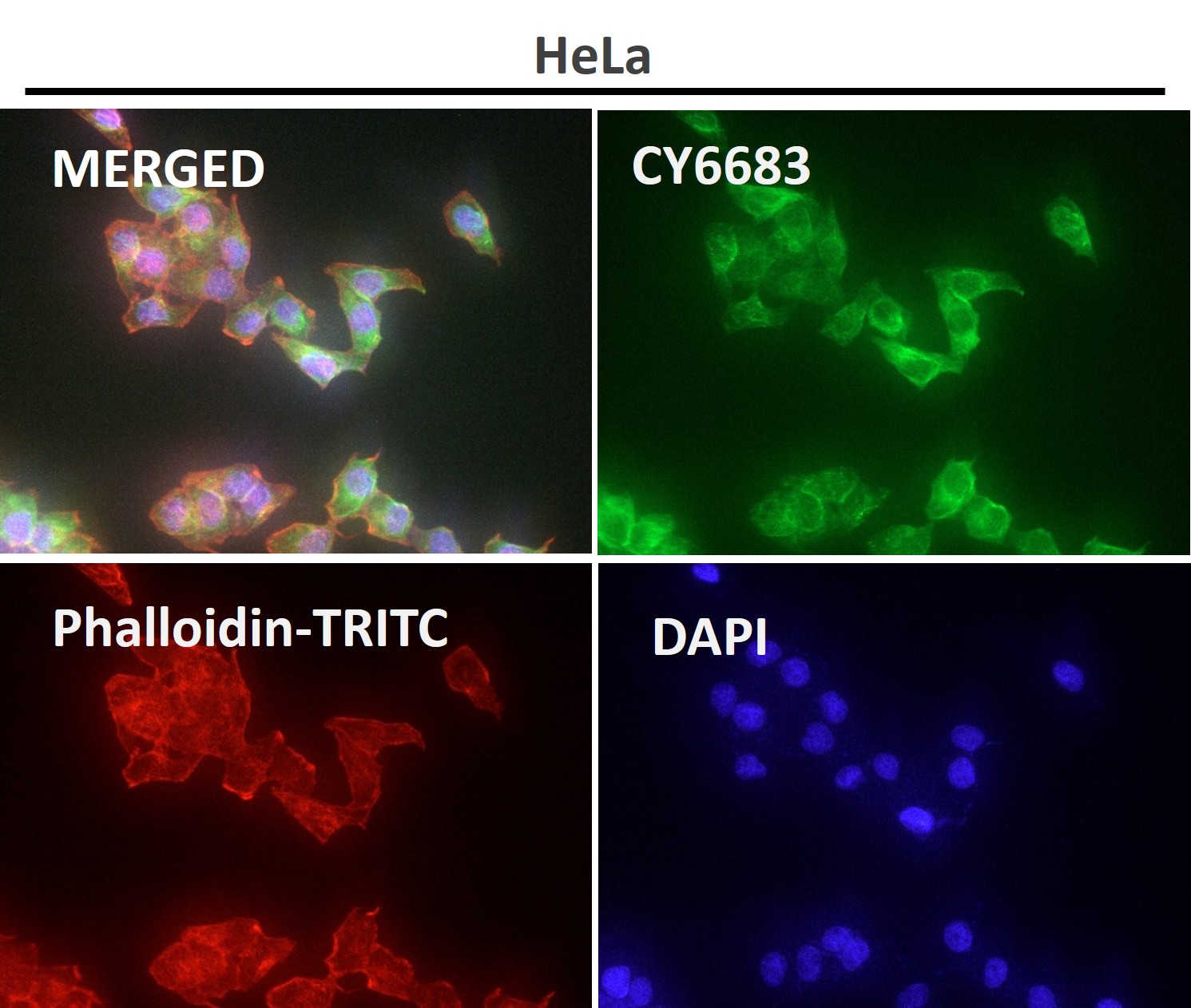 NCAM 1 Ab