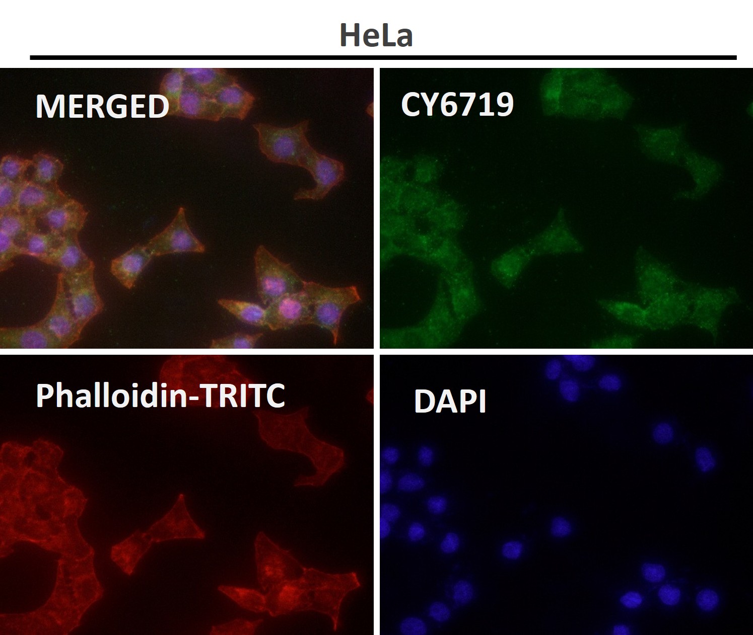 Ribosomal oxygenase 2 Ab