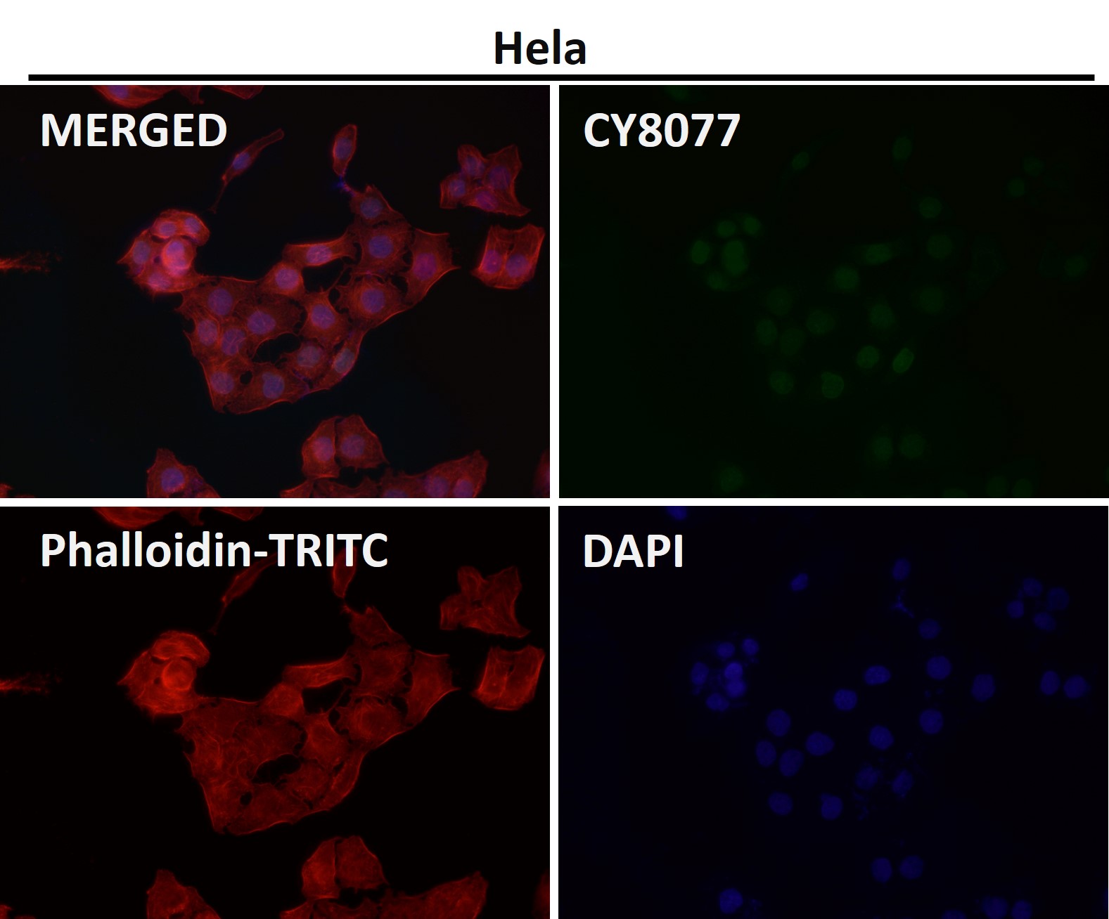 Crotonyl-Histone H2B type 2E (K11) Ab
