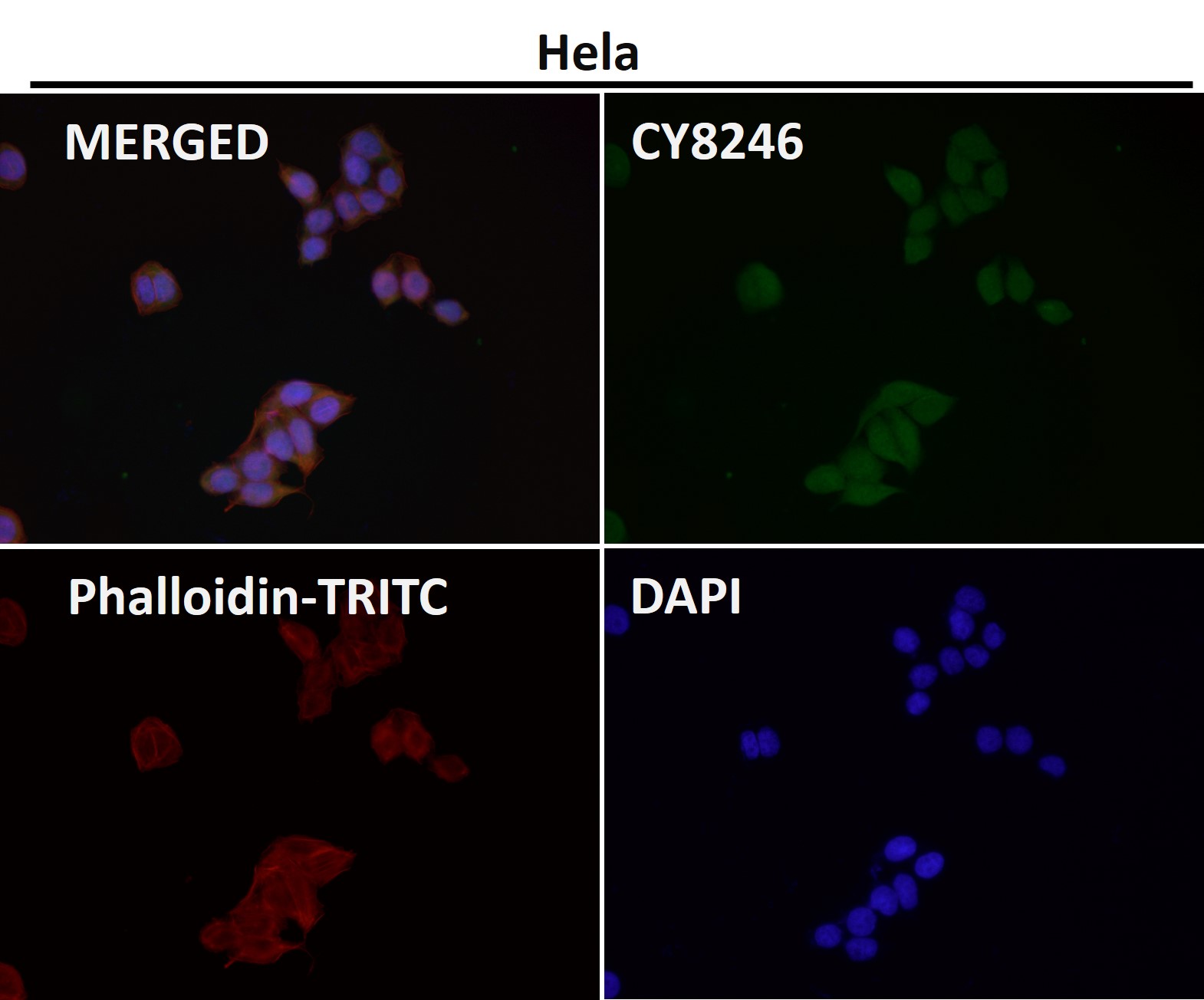 p70 S6 kinase beta 2 Ab