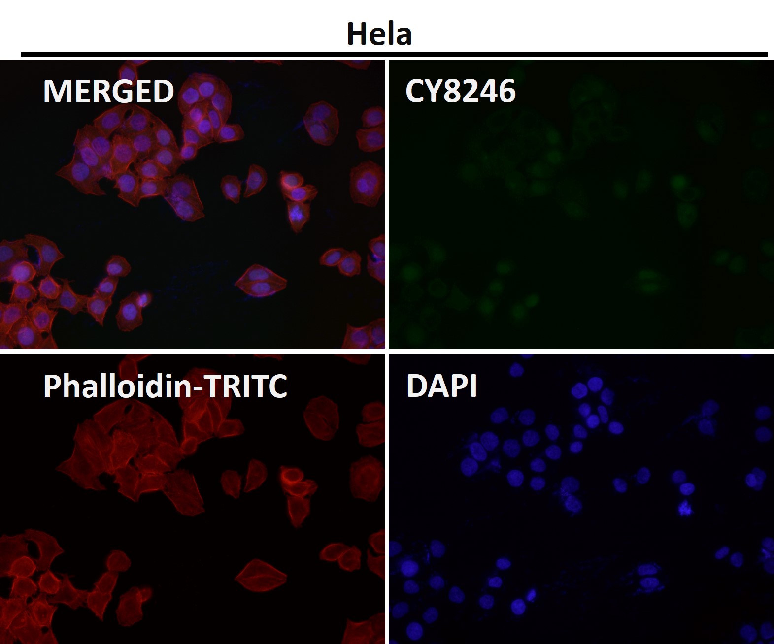 p70 S6 kinase beta 2 Ab