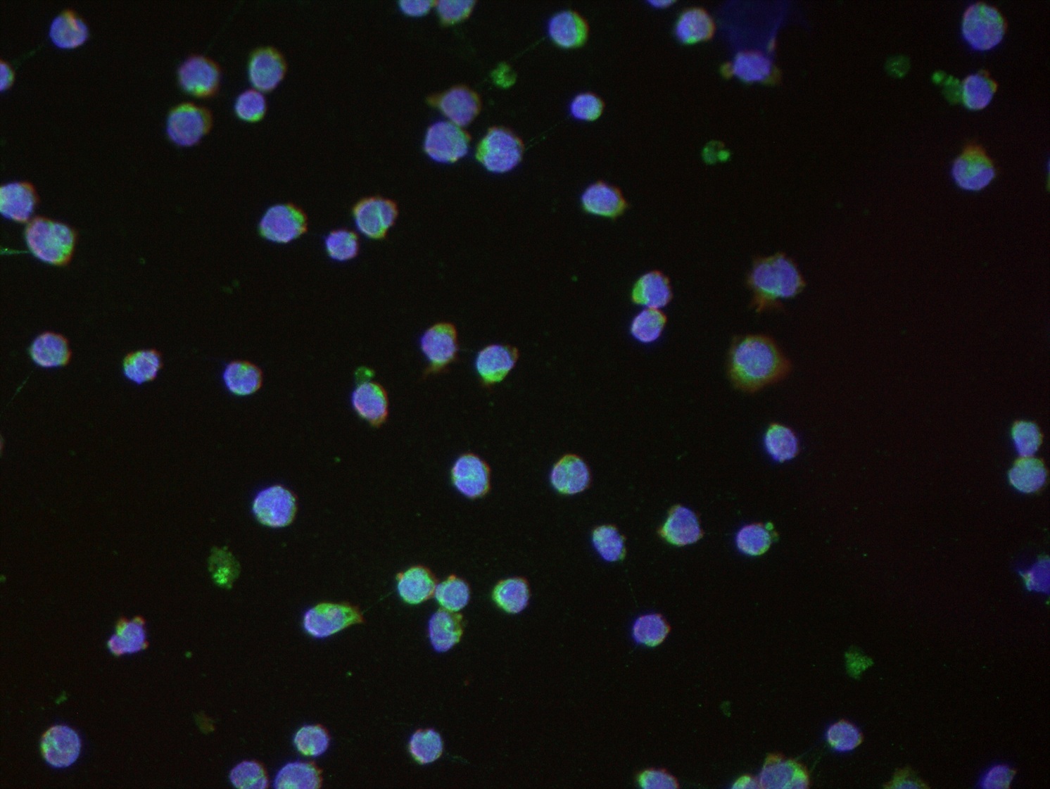 CD3 epsilon Ab