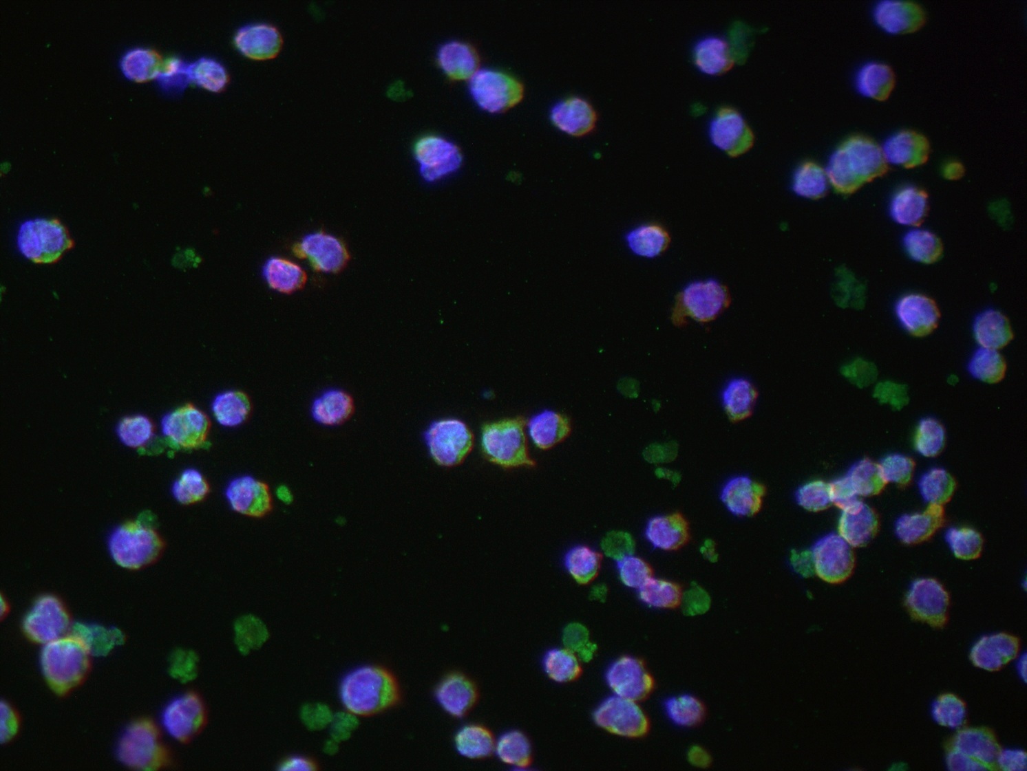 CD3 epsilon Ab