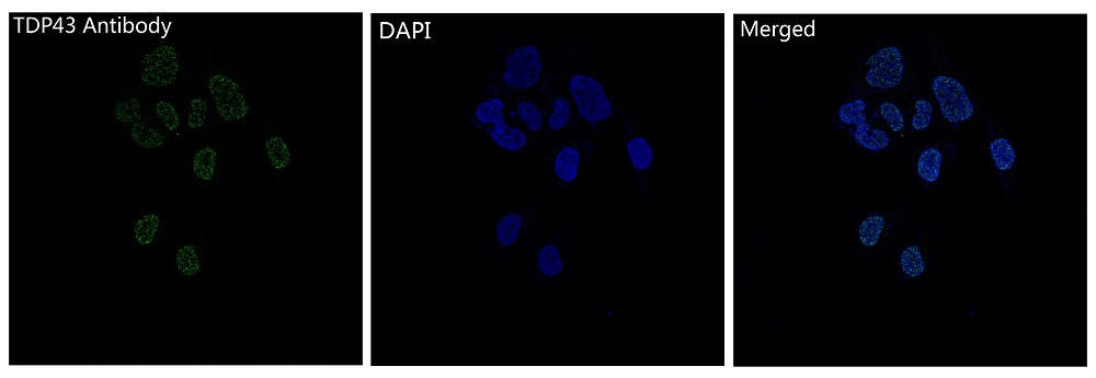TDP43 Ab