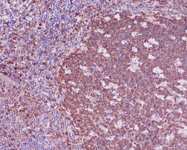 beta I Tubulin Ab