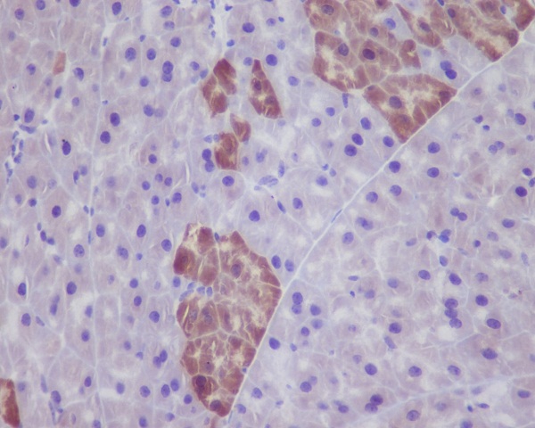 GFP tag Ab