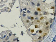 PCNA Ab